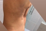 DICK