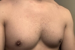 Pecs
