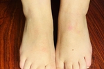 my feets