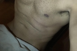 hugo4041 live Chaturbate webcam gallery thumbnail