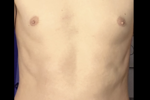 Shirt off!