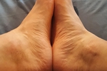 Feets