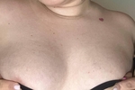 Teasing