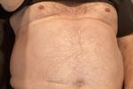 chest and belly