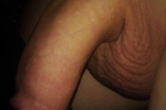 dick