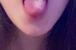Too Close