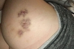 he bit my ass