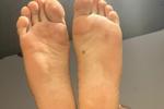 my feet