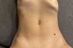 MyBody