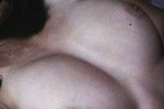 Nudes