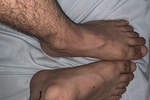 Feet