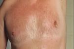 emilbuchmueller โ nude