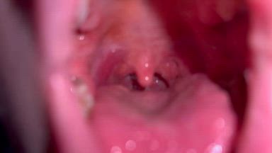 uvula