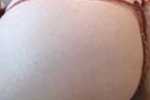 hot