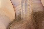 Dick Pics
