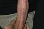 Fully naked Huge Circumcised Dick