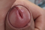 Huge Dick