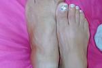 Feets