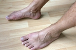 my feet (10 pics)