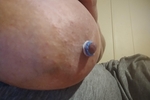 Nipple