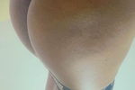 hot