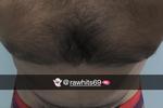Tease