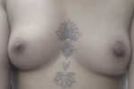 tits