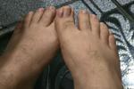 Feet