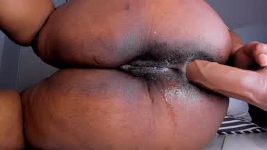 Anal