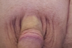 Shaved