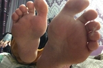 Feet and soles