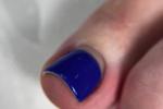 pedicure VERY close