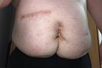 my belly