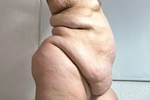 SEXY FAT