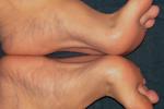 Feet