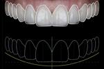 Wish list (Smile design) 😀