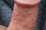Dick