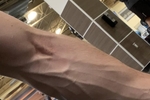 ridiculous forearm pump in gym