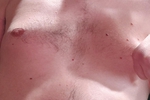 Chest pic
