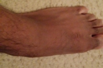 feet...