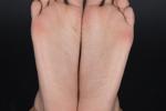 feet