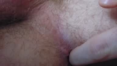 Hole