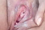urethra hot