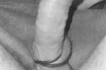 Dick