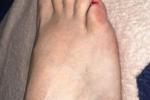 ale pantyhose — Red Nails, Black Stockings