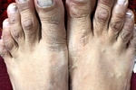 feet