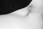 Nip