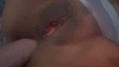 Anal is amazing