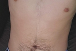 :)