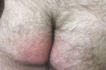 hairy ass